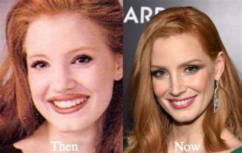 jessica chastain plastic surgery|Jessica Chastain, Before and After